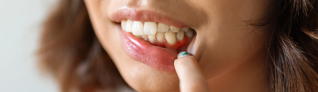 Signs You Need to Get Your Gums Checked In Wall Township NJ Signs You Need to Get Your Gums Checked In Wall Township NJ