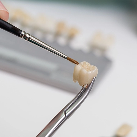 Dental Crown Held With Forceps