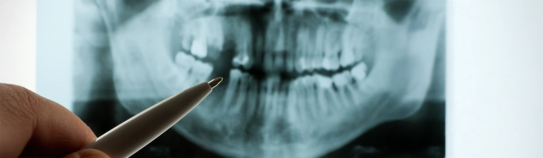 Digital X-Rays In Wall Township NJ Digital X-Rays In Wall Township NJ